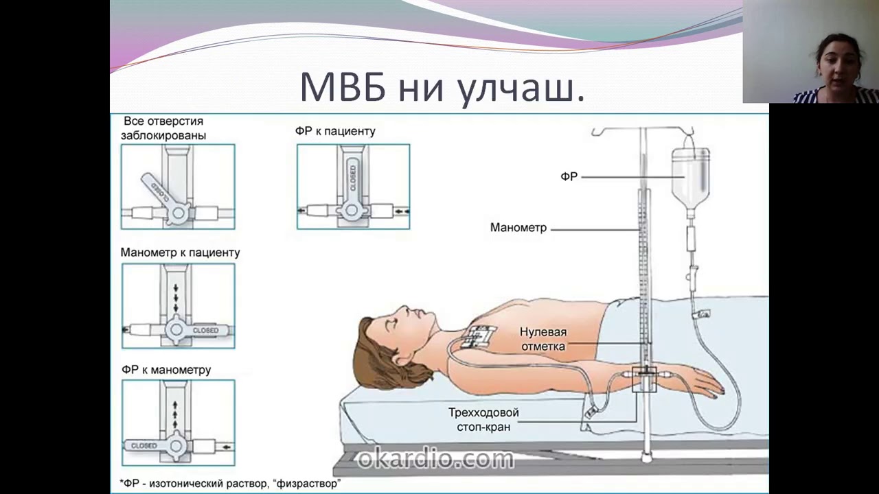 Метод измерения венозного давления. Аппарат для измерения центрального венозного давления. Фоебонотонометор Вальдмана. Аппарат Вальдмана для измерения венозного давления. Измерение венозного давления методом осмотра.